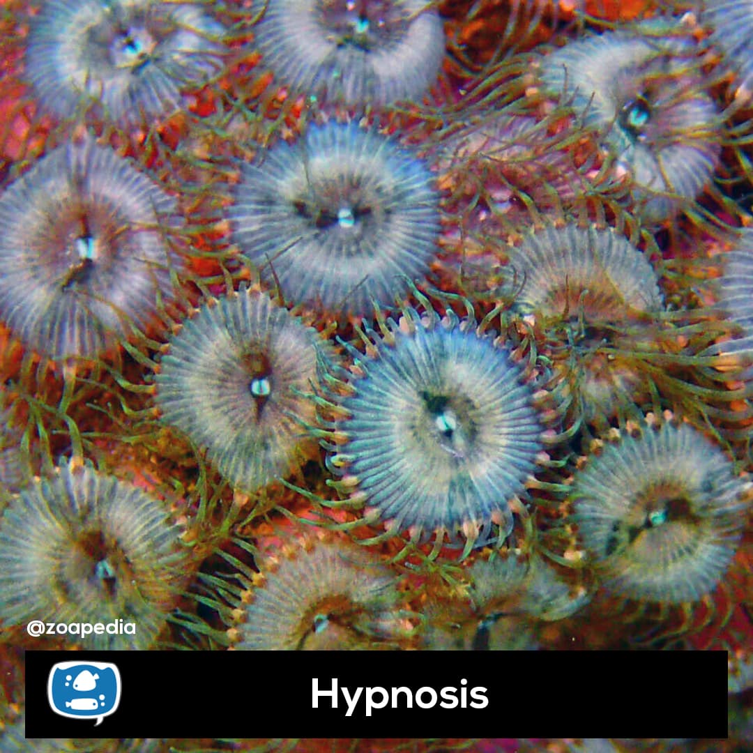 Hypnosis